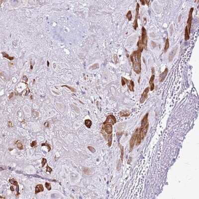 Immunohistochemistry-Paraffin: CASD1 Antibody [NBP1-91750]