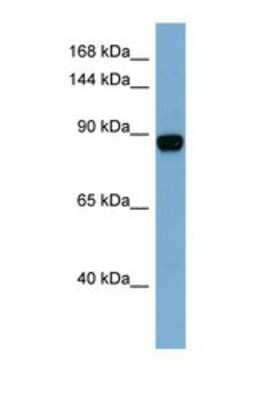 Western Blot: CASD1 Antibody [NBP1-69609]