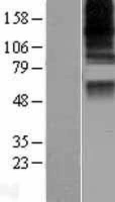 Western Blot: CASD1 Overexpression Lysate [NBL1-08702]