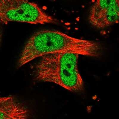 Immunocytochemistry/ Immunofluorescence: CASK Antibody [NBP1-86673]