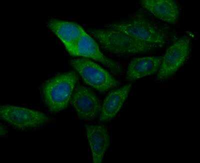 Immunocytochemistry/ Immunofluorescence: CASK Antibody [NBP2-76922]