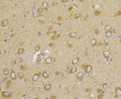 Immunohistochemistry: CASK Antibody [NBP2-76922]
