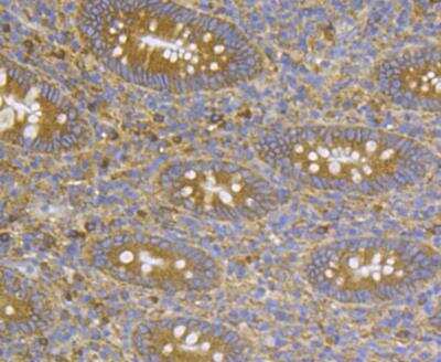 Immunohistochemistry: CASK Antibody [NBP2-76922]