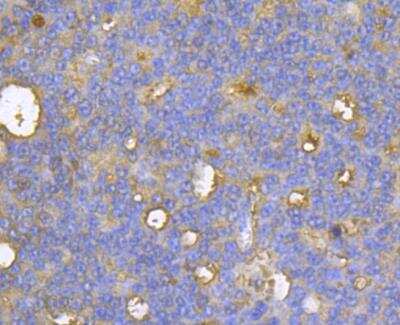Immunohistochemistry: CASK Antibody [NBP2-76922]