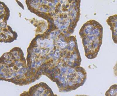 Immunohistochemistry: CASK Antibody [NBP2-76922]