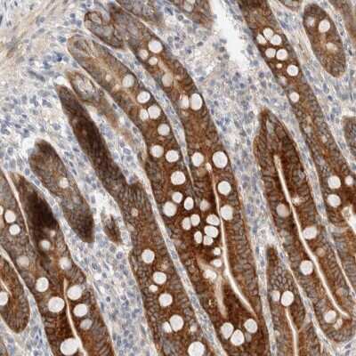 Immunohistochemistry-Paraffin: CASK Antibody [NBP1-86673]