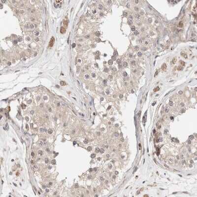 Immunohistochemistry-Paraffin: CASK Antibody [NBP1-86673]