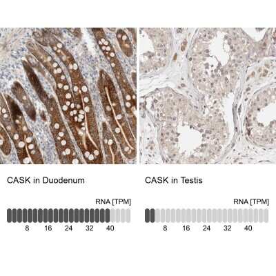 Immunohistochemistry-Paraffin: CASK Antibody [NBP1-86673]