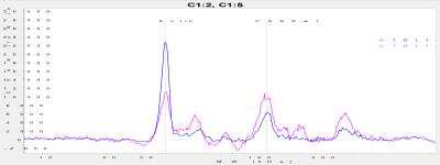 Simple Western: CASK AntibodyBSA Free [NBP2-41181]