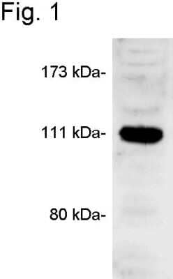 Western Blot: CASK Antibody [NB300-321]