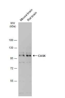 Western Blot: CASK Antibody [NBP2-15710]