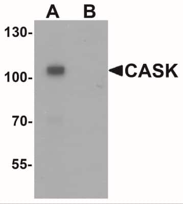 Western Blot: CASK AntibodyBSA Free [NBP2-41181]