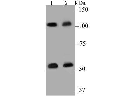 Western Blot: CASK Antibody [NBP2-76922]