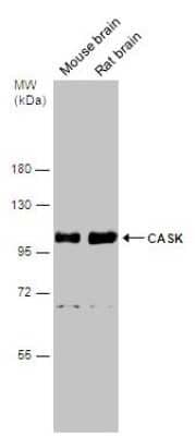 Western Blot: CASK Antibody [NBP3-13185]