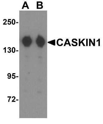 Western Blot: CASK Interacting Protein 1 AntibodyBSA Free [NBP2-81707]