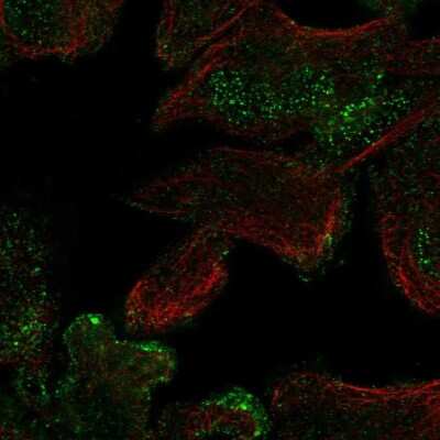 Immunocytochemistry/ Immunofluorescence: CASKIN2 Antibody [NBP2-62674]