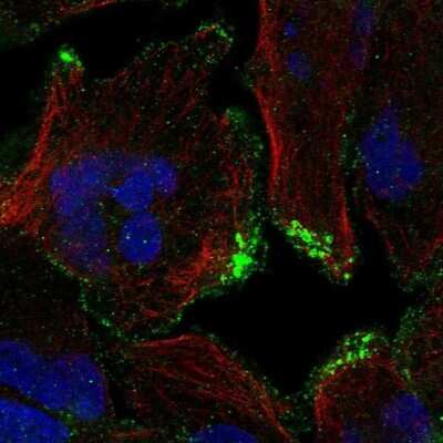 Immunocytochemistry/ Immunofluorescence: CASKIN2 Antibody [NBP2-68999]