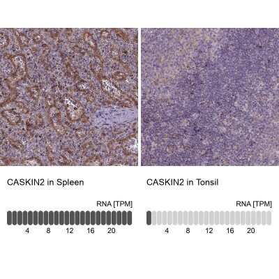 Immunohistochemistry-Paraffin: CASKIN2 Antibody [NBP2-62674]