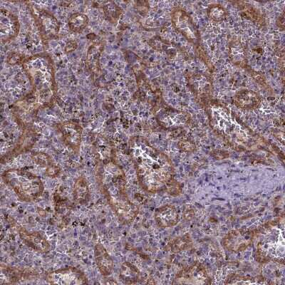 Immunohistochemistry-Paraffin: CASKIN2 Antibody [NBP2-62674]