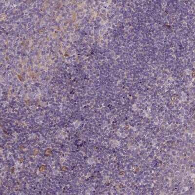 Immunohistochemistry-Paraffin: CASKIN2 Antibody [NBP2-62674]