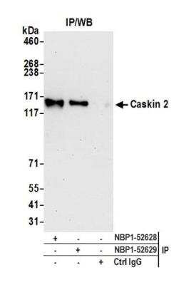 Immunoprecipitation: CASKIN2 Antibody [NBP1-52628]