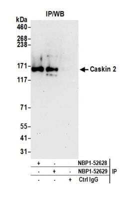 Immunoprecipitation: CASKIN2 Antibody [NBP1-52629]