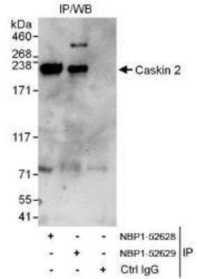 Western Blot: CASKIN2 Antibody [NBP1-52628]