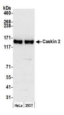 Western Blot: CASKIN2 Antibody [NBP1-52628]