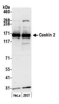 Western Blot: CASKIN2 Antibody [NBP1-52629]