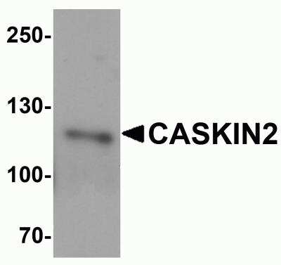 Western Blot: CASKIN2 AntibodyBSA Free [NBP2-81971]