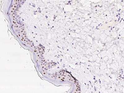 Immunohistochemistry: CASZ1 Antibody [NBP3-06281]
