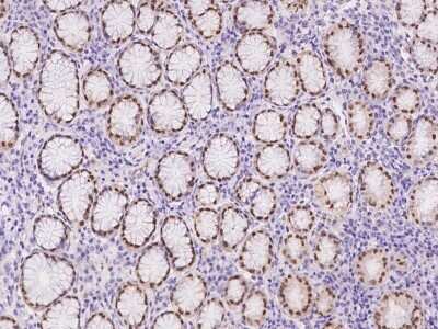 Immunohistochemistry-Paraffin: CASZ1 Antibody [NBP3-06281]