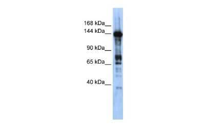 Western Blot: CASZ1 Antibody [NBP2-87125]