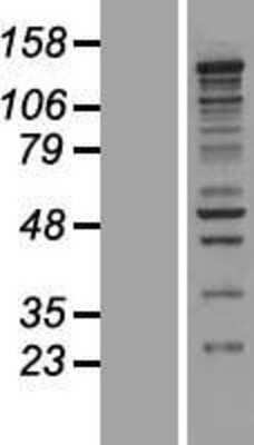 Western Blot: CASZ1 Overexpression Lysate [NBL1-08724]