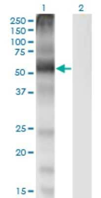 Western Blot: CAT1 Antibody (2B9) [H00006541-M02]