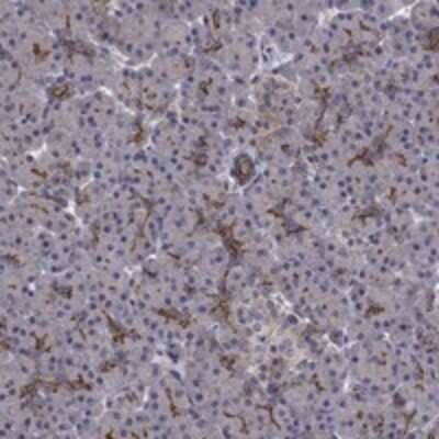 Immunohistochemistry-Paraffin: CAT1 Antibody [NBP3-17813]