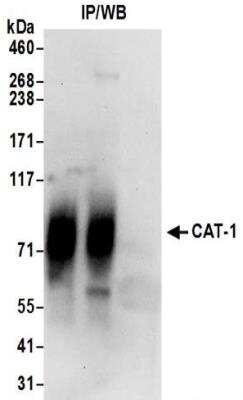 Immunoprecipitation: CAT1 Antibody [NBP2-32271]