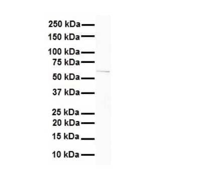 Western Blot: CAT1 Antibody [NBP1-59857]