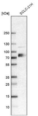 Western Blot: CAT1 Antibody [NBP1-90066]