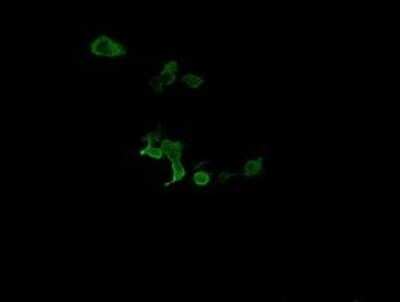 Immunocytochemistry/ Immunofluorescence: CATIP Antibody (OTI4B4) - Azide and BSA Free [NBP2-72506]
