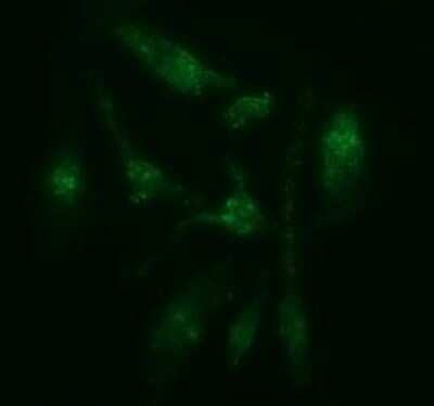 Immunocytochemistry/ Immunofluorescence: CATIP Antibody (OTI4B4) - Azide and BSA Free [NBP2-72506]