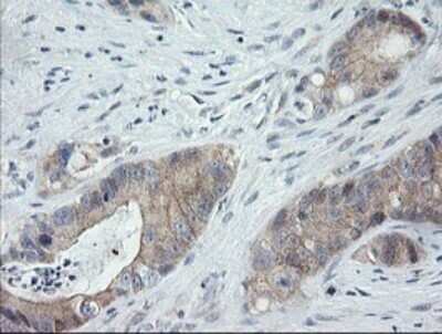 Immunohistochemistry: CATIP Antibody (OTI4B4) - Azide and BSA Free [NBP2-72506]