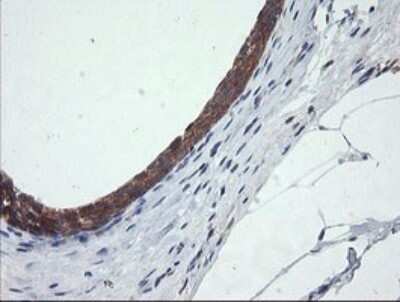 Immunohistochemistry: CATIP Antibody (OTI4B4) - Azide and BSA Free [NBP2-72506]