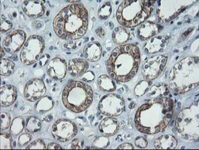 Immunohistochemistry: CATIP Antibody (OTI4B4) - Azide and BSA Free [NBP2-72506]