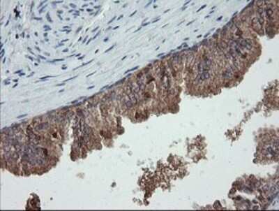 Immunohistochemistry: CATIP Antibody (OTI4B4) - Azide and BSA Free [NBP2-72506]