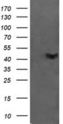 Western Blot: CATIP Antibody (OTI4B4)Azide and BSA Free [NBP2-72506]