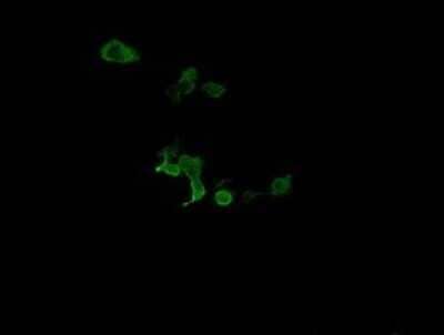 Immunofluorescence: CATIP Antibody (OTI4B4) [NBP2-45568]