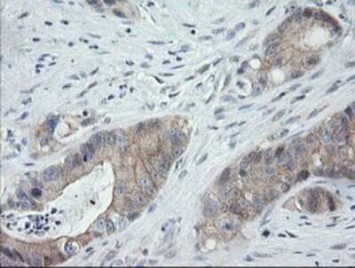 Immunohistochemistry: CATIP Antibody (OTI4B4) [NBP2-45568]