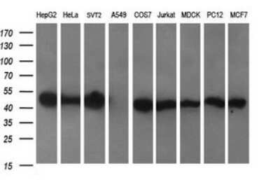 Western Blot: CATIP Antibody (OTI4B4) [NBP2-45568]