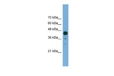 Western Blot: CATIP Antibody [NBP3-10634]